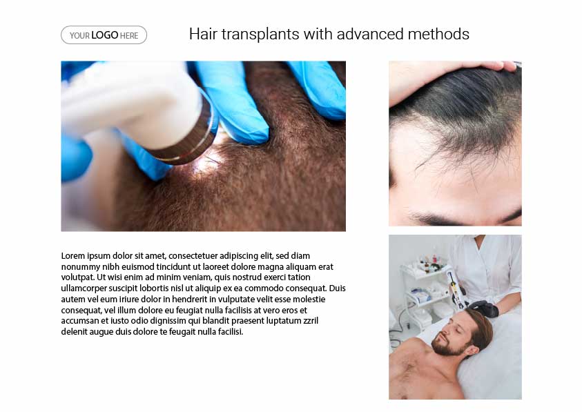 Hair Transplant templates2